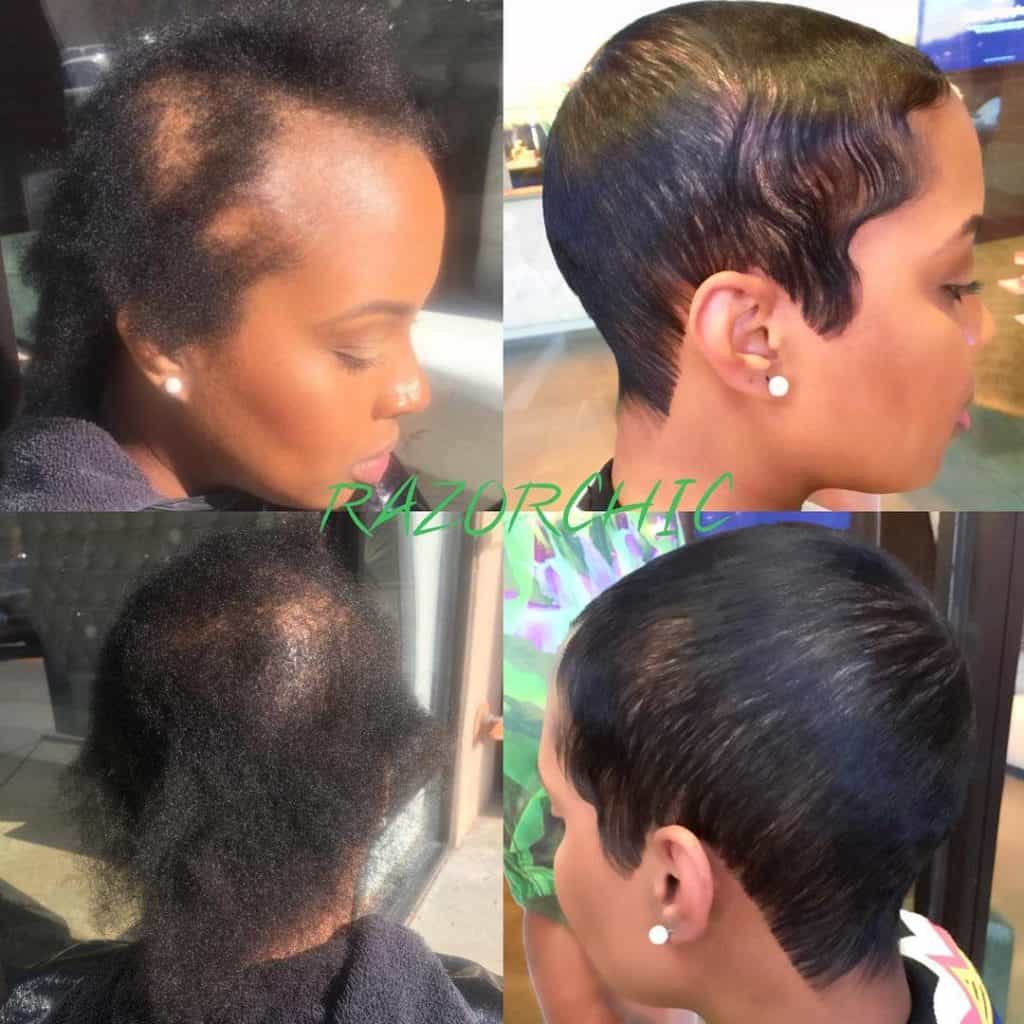 Thinning Hair In Black Women: What To Do When It Happens To You