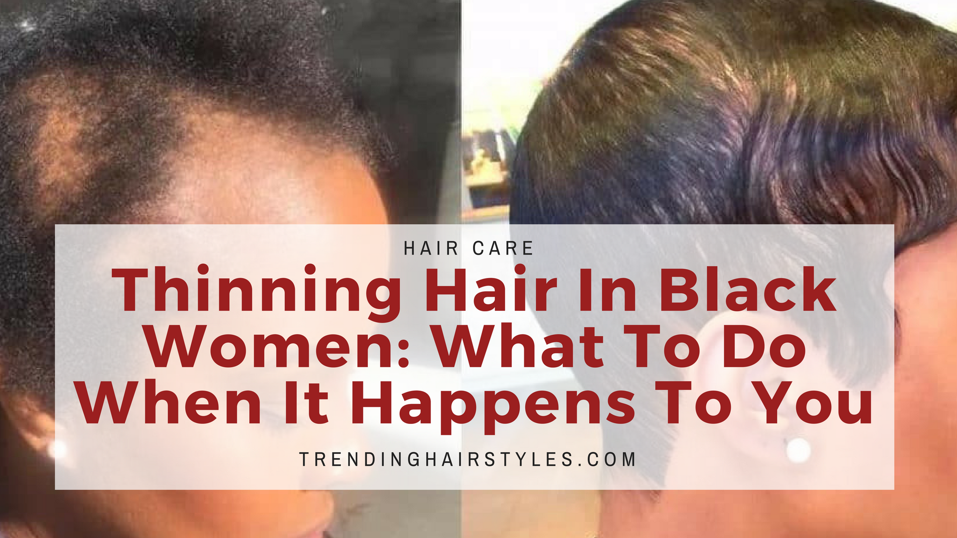 thinning hair in black women: what to do when it happens to you